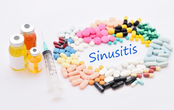 Sinus Infection