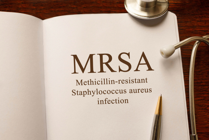 MRSA: Everything You Need to Know