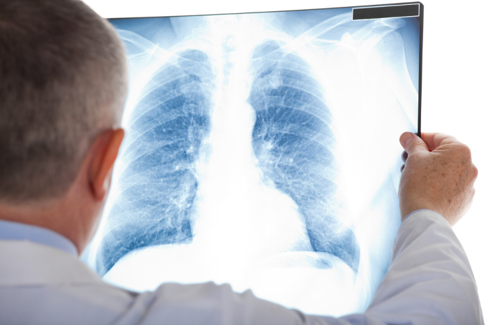 Pneumonia: What You Need to Know 