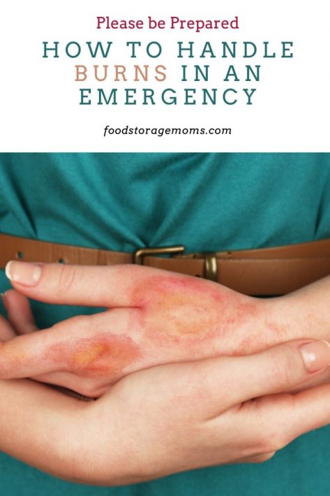 How to Handle Burns in an Emergency