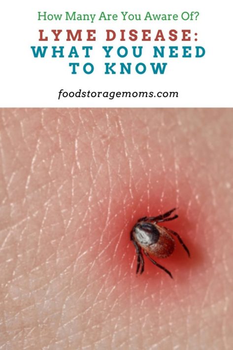 Lyme Disease: What You Need to Know