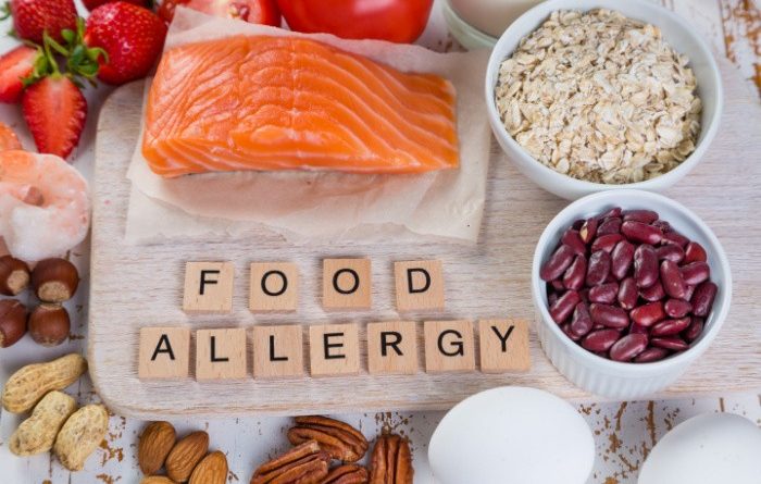 How to Prep for an Emergency with Food Allergies
