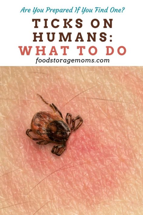 Ticks On Humans: What To Do