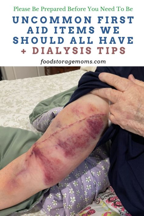 Arm with Dialysis Fistula Surgically Inserted