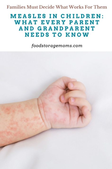 Measles on Hand With White Background