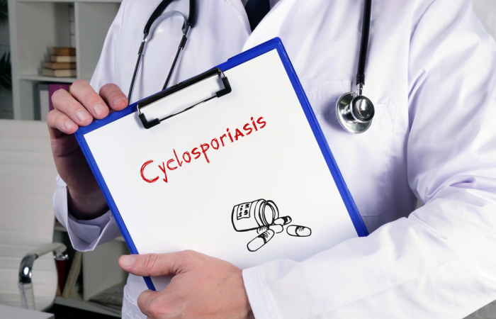 Health Care Concept Cyclosporiasis